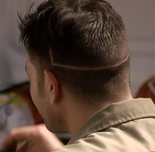 That look suspiciously like the cuts the Brain Surgeon makes.